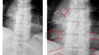 Dossier PAE - Rhumatologie 02