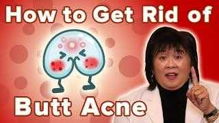 How To Get Rid Of Butt Acne