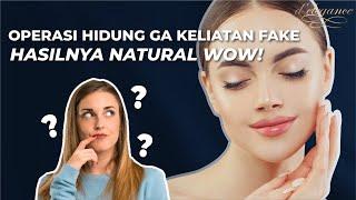 Operasi Hidung ga keliatan Fake, Hasilnya Natural WOW!