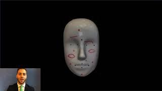 Intraoperative Navigation In Facial Plastic Surgery With Augmented Reality