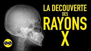 IMAGERIE MEDICALE #1 : La découverte des Rayons X
