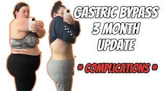 Gastric Bypass 3 Month Update! | complications | weight loss