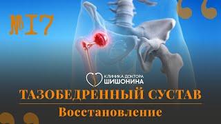 Как забыть о боли в тазобедренных суставах: отвечает хирург в новом выпуске «Хорошей медицины» ️