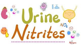 How to diagnose Urinary Tract Infections - UTIs - Urine Nitrites (Urinalysis) - Labs Playlist