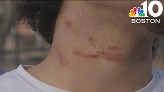 Mother of teens assaulted at YMCA speaks out