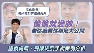 男性整形｜偷偷就變帥！自然系男性整形大公開！男性隱痕提眉、提眼瞼肌矯正案例分析｜晶華醫美診所 台北 桃園整形推薦