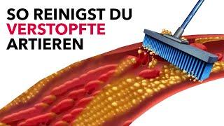 Das sind die 5 besten Mittelchen, um verstopfte Arterien zu reinigen!