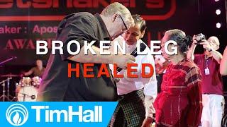 Broken Leg Healed - Evangelist Tim Hall