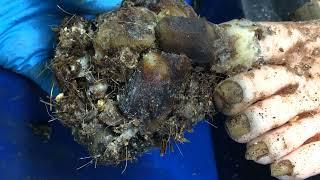 Curly ingrown fungi and bacteria toenails hiding impurities 0993
