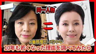 【整形Vlog】　若返りに成功した彼女の話、第2弾　術後の話を今から聞かせて頂きます　#童顔  #若返り #vlog