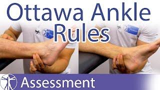 The Ottawa Ankle Rules | Ankle Fracture Clinical Prediction Rule