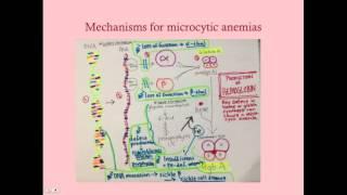 Microcytic Anemia - CRASH! Medical Review Series