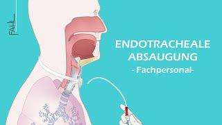 Endotracheale Absaugung für Pflegepersonal | Animation | Fahl Medizintechnik-Vertrieb GmbH