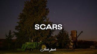 (FREE) Zach Bryan x Shaboozey Type Beat "Scars"