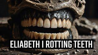 THE ROTTING TEETH OF ELIZABETH I