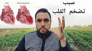 اسباب تضخم القلب والعلاج بكل سهولة