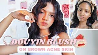 NATURAL FLUSHED DOUYIN BLUSH ON BROWN ACNE SKIN