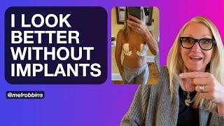 I look BETTER without implants | Breast Explant Journey Part 4