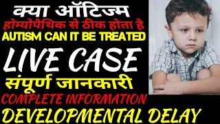 Autism treatment|Developmental delay| Sign and symptoms of global Developmental delay|ehomeovision