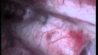 Foreign body in esophagus thoracoscopically , dog