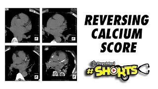 #SHORTS Reversing Calcium Score