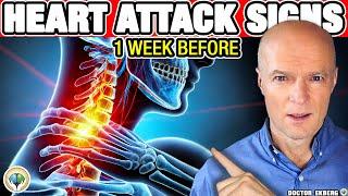 10 Warnings Signs Of HEART ATTACK A Week BEFORE It Happens