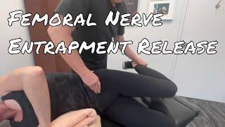 Femoral Nerve Entrapment Release - Motion Specific Release