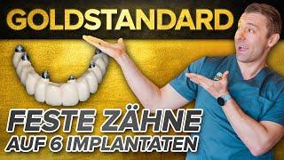 Feste Zähne auf 6 Implantaten - Der Goldstandard in der Implantologie