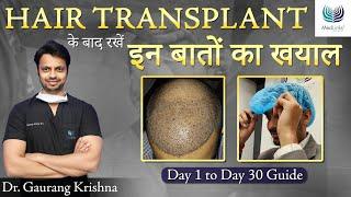 हेयर ट्रांसप्लांट के बाद क्या करे? After Hair Transplant Care in Hindi | Medlinks Hair Transplant