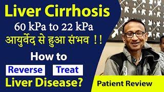 Liver Cirrhosis- 60 kPa to 22 kPa, आयुर्वेद से हुआ संभव !! How to Reverse / Treat Liver Disease?