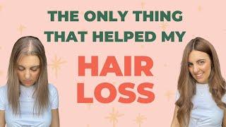 The Only Thing That Helped My Hair Loss!