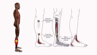 БОЛЬ В ГОЛЕНИ, ЛОДЫЖКЕ И СТОПЕ  ТРИГГЕРНЫЕ ТОЧКИ