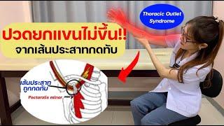 ปวดยกแขนไม่ขึ้น จากเส้นประสาทถูกกดทับ (Thoracid outlet syndrome)