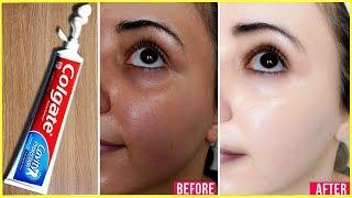 Apply Toothpaste on Your Skin and See Magical Result within 1 Hour ¦Amazing Toothpaste Beauty Hacks