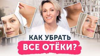 Как убрать ВСЕ отёки? 6 видов отёков лица и борьба с ними