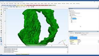 How to Assess the Mitral Valve Based on CT Images | Mimics Innovation Suite | Materialise Medical