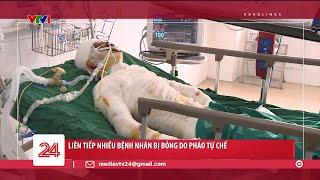 Liên tiếp nhiều bệnh nhân bị bỏng do pháo tự chế | VTV24