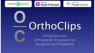 Managing infected fractures