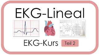 EKG Lineal richtig verwenden - Praktische Tipps (Frequenz, Lagetyp, Zeiten, Fallbeispiel)