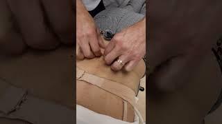 Low Back Skin Rolling To Remove Back Pain