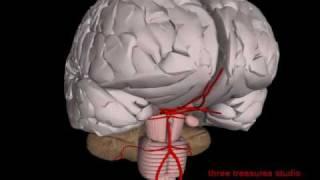 intracranial aneurysm and the 3D brain