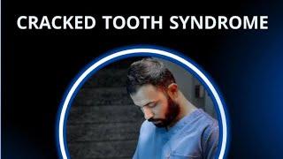 Cracked Tooth Syndrome || Dr-Ahmed Ibrahim (dmp)