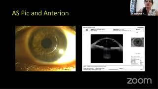 AIOC2021-IC145-Topic-Dr.SWAPNA NAIR