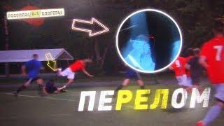 Герман сломал ногу в первом матче. БЛОГЕРЫ VS Россия24 (серия #4 ПЕРВАЯ ИГРА)