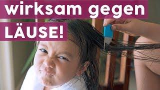 5 Hausmittel gegen Kopfläuse | MOM-LIFE