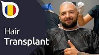 My Experience with Istanbul Vita from Romania | Hair Transplant in Istanbul / Turkey