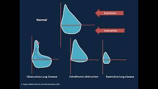 Respiratory Disorders