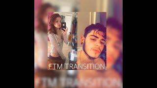 FTM TRANSITION // ONE YEAR ON TESTOSTERONE