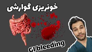 خونریزی گوارشی |GI BLEEDING |علایم|مکانیسم اثر |درمان