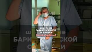 Шрам после бариатрической операции большой и безобразный?